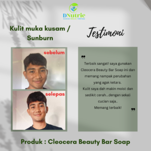 TESTIMONI - CLEOCERA BEAUTY BAR SOAP